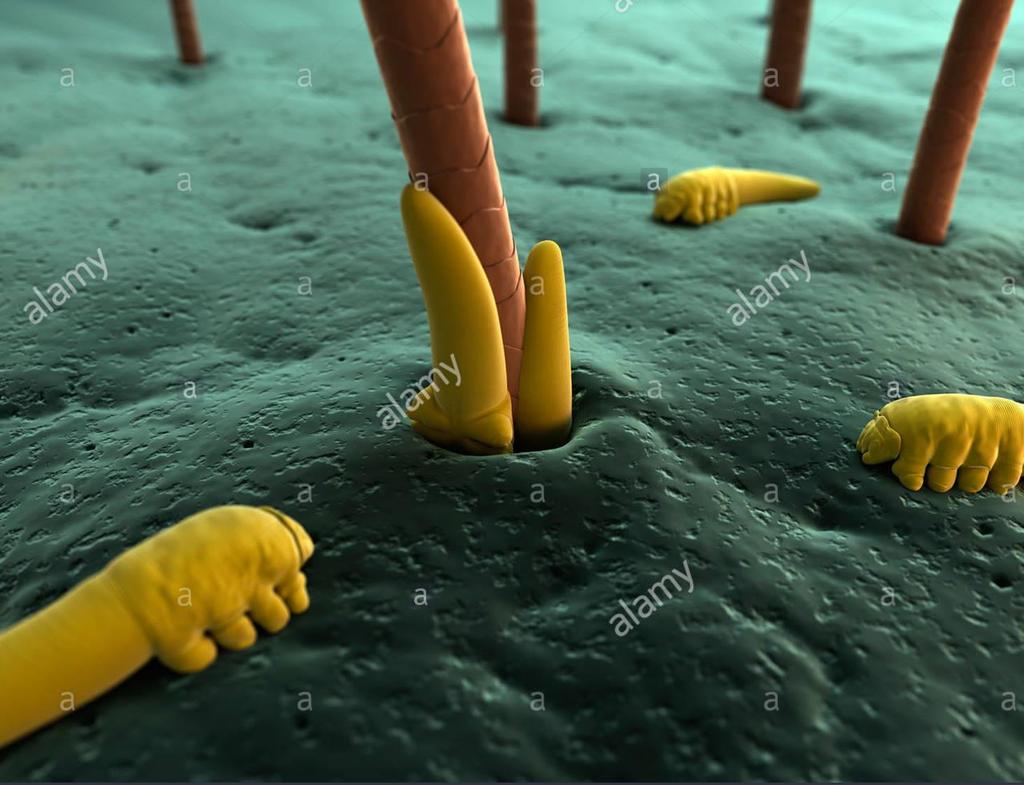 DEMODEX MITES Τροφή Λιπώδεις εκκρίσεις (σμήγμα), δερματικά κύτταρα (σήραγγες) *Αλλαγές στη φύση του σμήγματος Μετάδοση Άμεση επαφή.