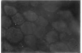 κυττάρων σε ένα μικροσκόπιο για τον εντοπισμό δυστροφίνης. Η δοκιµή βασιζόµενη στην τεχνική της αποτύπωσης κατά Western αποτελεί μια χημική διεργασία που ελέγχει την χημική παρουσία της δυστροφίνης.