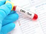 ΚΥΤΤΑΡΟΜΕΓΑΛΟΙΟΣ (CMV) CD4+< 50 κυττ/mcl Απαραίτητη η διάκριση μεταξύ λοίμωξης και νόσου CMV DNA με PCR για ανίχνευση του ιού και παρακολούθηση της θεραπείας Βιοψία για