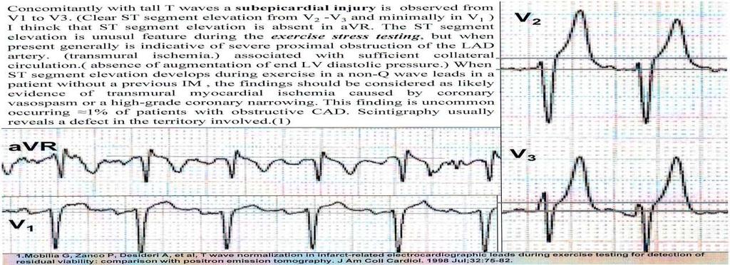 ΒΙΒΛΙΟΓΡΑΥΙΑ JACC