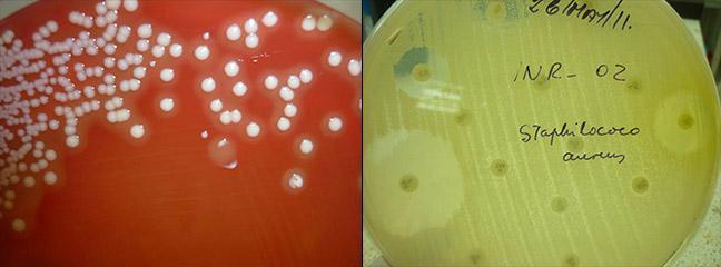 Σταφυλοκοκκικό απόστημα (Staphylococcus aureus) Καλλιέργεια του κλινικού δείγματος στο