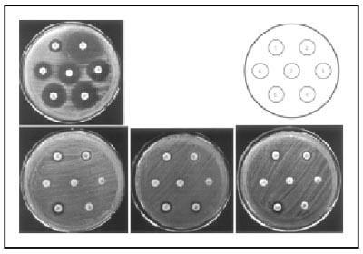 Αντιβιογράμματα από MRSA στελέχη