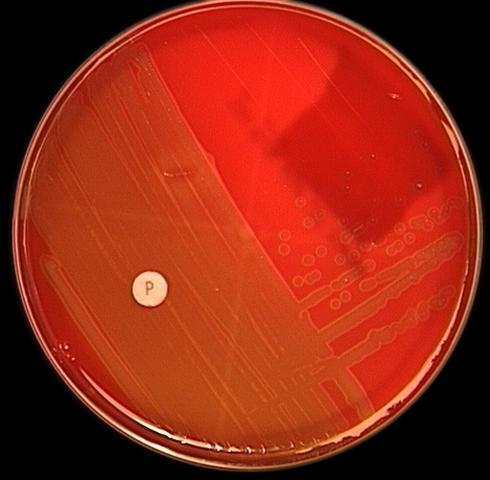 Streptococcus pneumoniae
