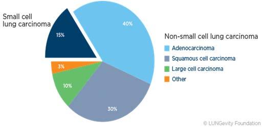 ΒΡΟΓΧΟΓΕΝΗΣ ΚΑΡΚΙΝΟΣ Μικροκυτταρικός (ΜΚΠ)-15% Μη μικροκυτταρικός (ΜΜΚΠ)-85% Αδενοκυτταρικό (Adenocarcinoma) Πλακώδες (Squamous) Μεγαλοκυτταρικό (Large Cell)