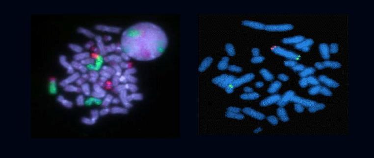 In situ υβριδοποίηση με φθορισμό Αλληλουχία σημασμένη με φθορίζουσα χρωστική που υβριδοποιείται στο ομόλογο χρωμόσωμα Η