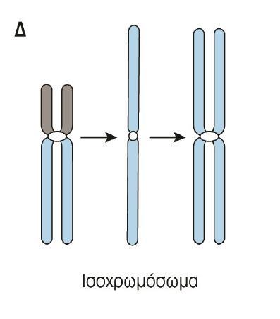 Ισοχρωμοσώματα Ο μικρός βραχίονας απουσιάζει και έχει διπλασιαστεί ο μεγάλος βραχίονας Ένα άτομο που με 46 χρωμοσώματα που φέρει ισοχρωμόσωμα θα έχει 3 αντίγραφα του γενετικού υλικού του ενός