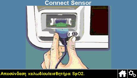 Αποσύνδεση του αισθητήρα από το σύστημα παρακολούθησης Αν ο αισθητήρας έχει αποσυνδεθεί από το σύστημα παρακολούθησης, εμφανίζεται η οθόνη που εικονίζεται δεξιά.