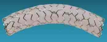 PTFE COVERED STENT PTFE COVERED STENT είναι κατασκευασµένο από stainless steel και