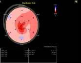 45-50mmHg