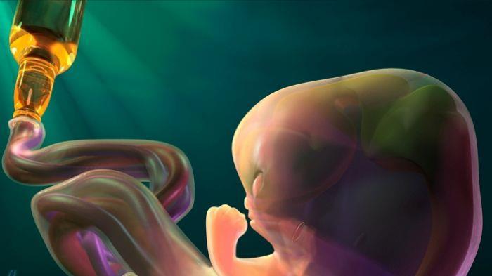 Σύνδρομο εμβρυικού αλκοολισμού ΣΕΑ είναι η παρουσία γενετικών ανωμαλιών στο νεογνό που