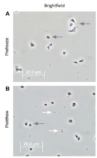 Μικρομόρια (PMPs) 1. Κομμάτια μεμβρανών 2. με ή χωρίς κυτταροσκελετό, & 3.