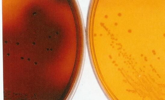 Διαφορές στην ανάπτυξη στο ίδιο υλικό Bacteroides fragilis