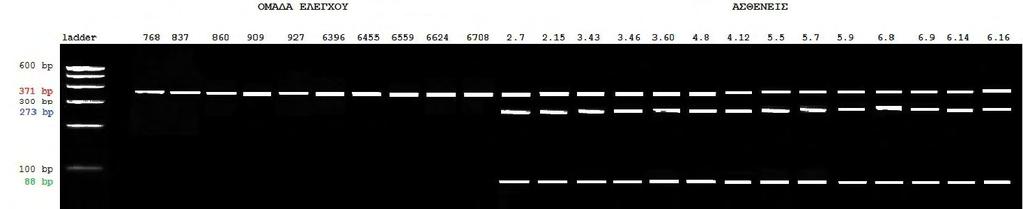 Εικόνα 28: Τα προιόντα PCR ηλεκτροφορήθηκαν σε γέλη αγαρόζης 3,5% για επιβεβαίωση της σημειακής μετάλλαξης στο εξόνιο 7. Το μέγεθος του προιόντος είναι 371bp εφόσον δεν υπάρχει η μετάλλαξη.