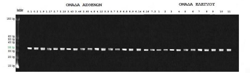 Το μέγεθος του αρχικού προιόντος είναι 272bp και μετά την nested PCR, 138bp. Στην γραμμή 1 περιλήφθηκε DNA ladder gelpilot 100bp plus. Στην γραμμή 2 περιλήφθηκε αρνητικός μάρτυρας χωρίς DNA template.