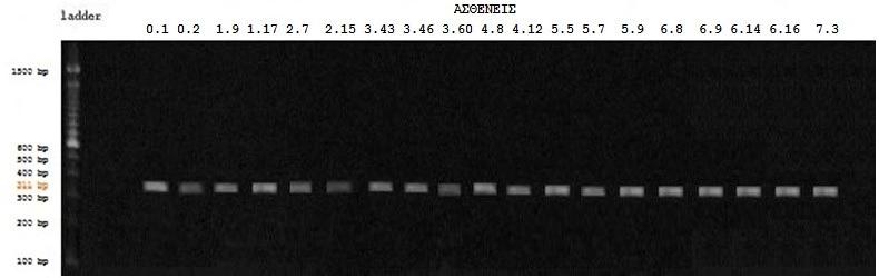 3. Εξόνιο 4 Εικόνα 24: Τα προιόντα PCR ηλεκτροφορήθηκαν σε γέλη αγαρόζης 2%. Το μέγεθος του προιόντος είναι 3118bp. Στην γραμμή 1 περιλήφθηκε DNA ladder gelpilot 100bp plus.