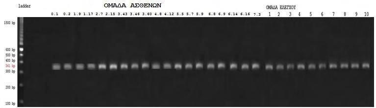 5. Εξόνιο 6 Εικόνα 26: Τα προιόντα PCR ηλεκτροφορήθηκαν σε γέλη αγαρόζης 2%. Το μέγεθος του προιόντος είναι 270bp. Στην γραμμή 1 περιλήφθηκε DNA ladder gelpilot 1500bp plus.