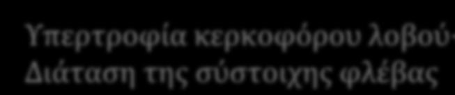 + αντικατάσταση από ινώδη