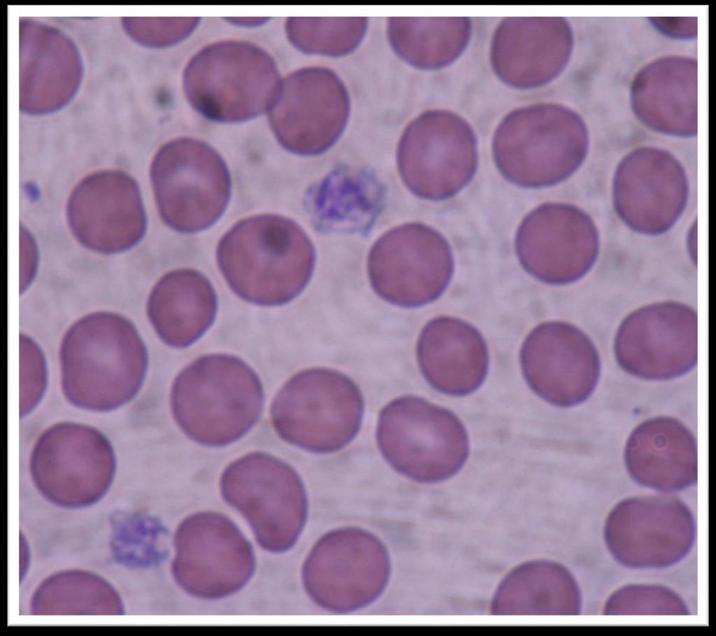Αιμοπετάλια Μικρά, δισκοειδή, διάφανα, κυτταρικά