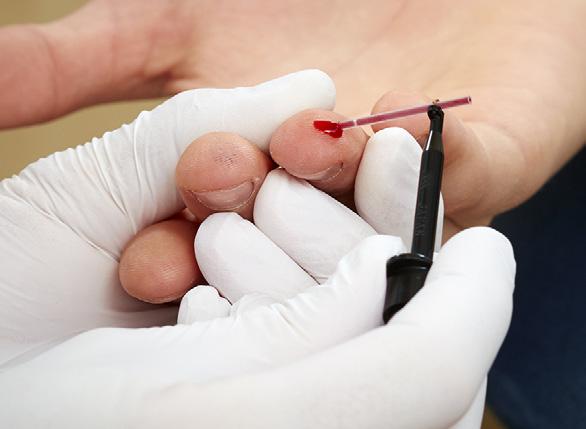 4. Συλλογή δείγματος Συλλογή δειγμάτων τριχοειδικού αίματος 6 Συλλογή δείγματος Εικόνα 61: Συλλογή δείγματος z Μετά το τρύπημα, σκουπίστε την πρώτη σταγόνα αίματος με ένα καθαρό χαρτομάντιλο ή μια