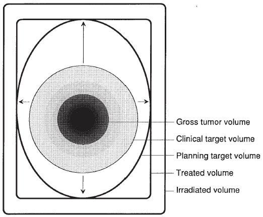 PTV volume.