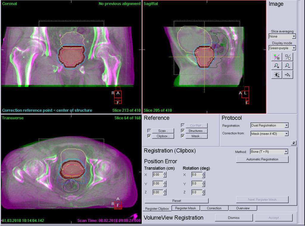 patient. An offline review as well as an offline registration between these images and the reference CT image can be made.