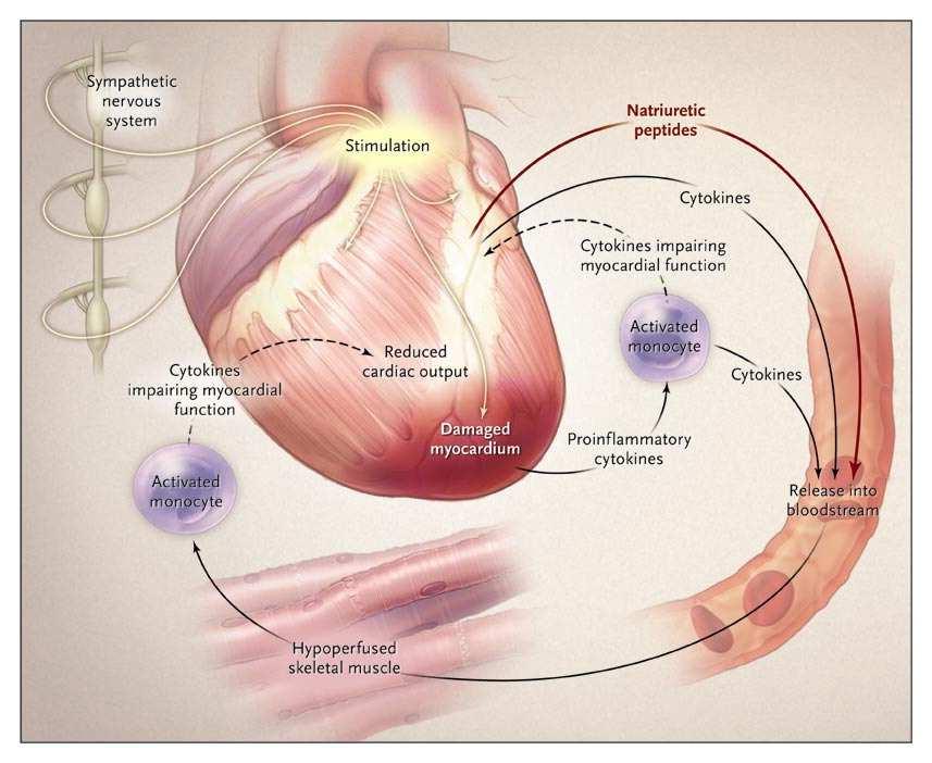 The Cytokine Hypothesis of Heart Failure.