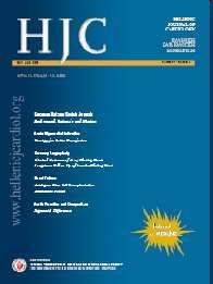 Hellenic J Cardiol. 2005 Sep-Oct;46(5):324-9. Intrapericardial cisplatin administration after pericardiocentesis in patients with lung adenocarcinoma and malignant cardiac tamponade.