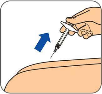 Βήμα 5: Πιέστε αργά το έμβολο προς τα κάτω για να εγχύσετε όλο το διάλυμα Benepali. Βήμα 6: Όταν η σύριγγα αδειάσει, αφαιρέστε τη βελόνα από το δέρμα διατηρώντας τη γωνία υπό την οποία την εισαγάγατε.