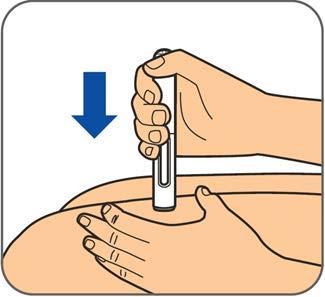 Βήμα 7: Απομακρύνετε την κενή συσκευή τύπου πένας από το δέρμα. Το προστατευτικό της βελόνας θα καλύψει πλήρως τη βελόνα.