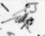 RSV Paramyxovirus (-) sense singlestranded RNA Enveloped 90throughout life ΠΝΕΥΜΟΝΙΑ ΑΠΟ RSV AΝΑΠΝΕΥΣΤΙΚΟΣ ΣΥΓΚΥΤΙΑΚΟΣ ΙΟΣ ΚΛΙΝΙΚΗ ΕΙΚΟΝΑ Δεν ξεχωρίζει από άλλες