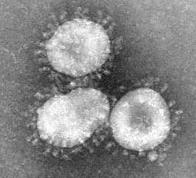 SARS Coronavirus SARS: Severe Acute Respiratory