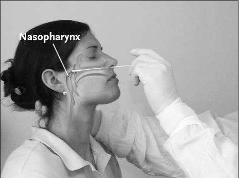 CDC swab kit available Method: horizontal, away from nasal septum 1. Καλλιέργεια ιού 2. Ταχεία ανίχνευση Ag 3. Ορολογικός έλεγχος 4.