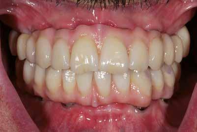 Αυτό το περιστατικό μας απέδειξε ότι οι ικανότητες των οδοντιάτρων και των οδοντοτεχνιτών σε συνδυασμό με την ακρίβεια που επιτυγχάνεται με τη νέα ψηφιακή ροή εργασιών δίνει τη