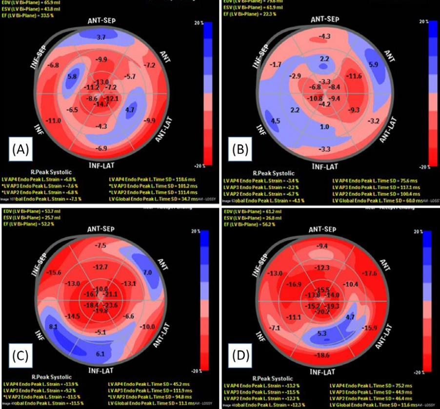 2-years FU Di Bella et al Echocardiography 2018