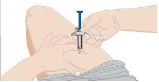 προς τα κάτω υπό γωνία 90 μοιρών. o ΜΗΝ τοποθετείτε το δάκτυλό σας στο έμβολο κατά την εισαγωγή της βελόνας.