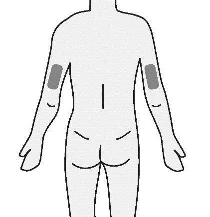Σημαντικό: Είναι σημαντικό να χρησιμοποιείτε διαφορετικές θέσεις ένεσης για να διατηρείται το δέρμα υγιές.