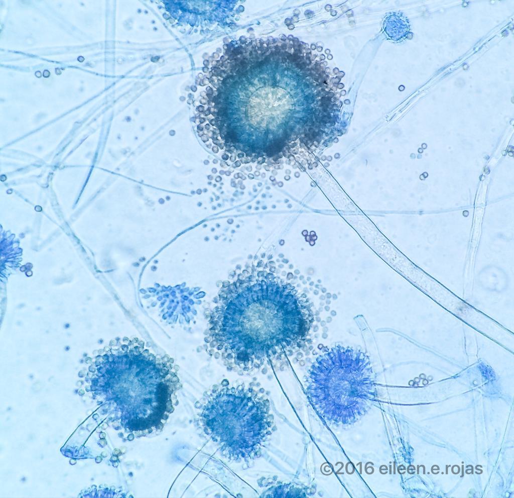 Μύκητες Ευκαρυωτικά (5-10 μm) Κυτταρικό τοίχωμα από χιτίνη