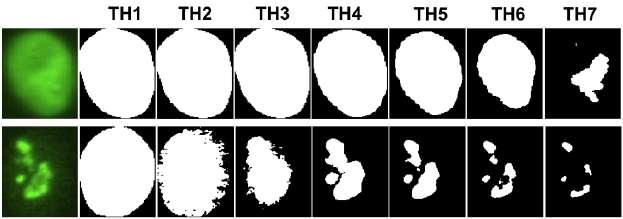 Παράδειγμα απόλυτου κατωφλίου σε εικόνα κυττάρου https://www.researchgate.