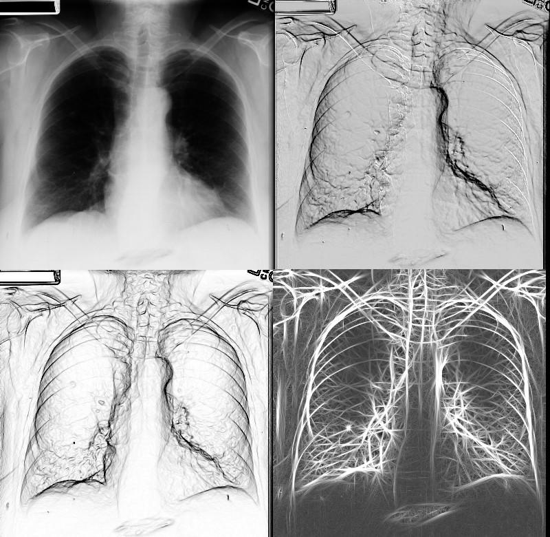 CT) 35