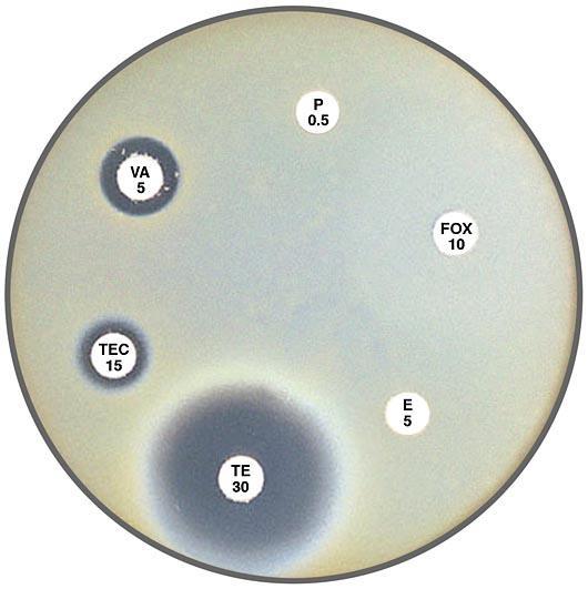 Vancomycin