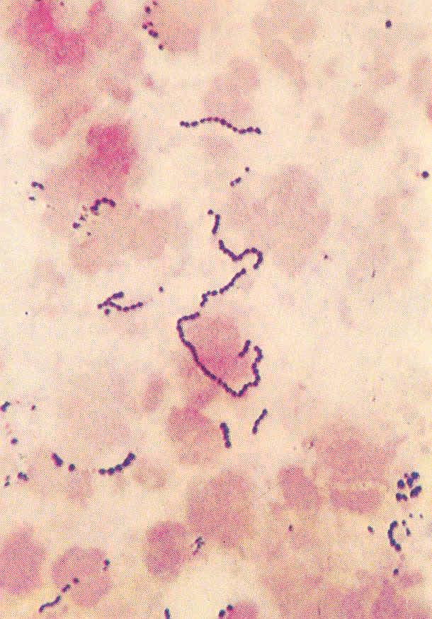 Genus Streptococcus Γένος Streptococcus Το γένος περιλαμβάνει τουλάχιστον 68 διαφορετικά είδη τα οποία έχουν παγκόσμια εξάπλωση, συναντώνται σχεδόν παντού στη φύση κυρίως όμως αποτελούν μέρος της