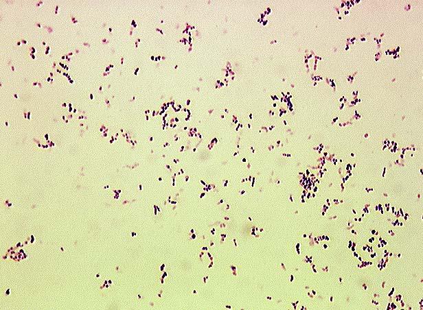 Genus Rhodococcus Γένος Rhodococcus Το γένος περιλαμβάνει 12 είδη που διαφέρουν σημαντικά μεταξύ τους σε μορφολογία, χαρακτηριστικά, βιοχημικές ιδιότητες και ικανότητα να προκαλούν νόσημα.