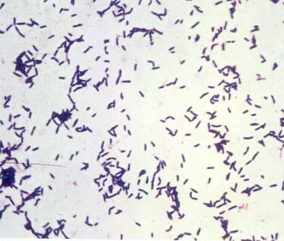 Actinomycetes Γένος Actinomyces Πρόκειται για Gram θετικά βακτήρια, με τάση να σχηματίζουν διακλαδώσεις. Είναι ακίνητα και μη σπορογόνα.