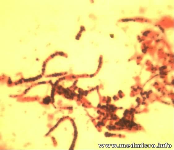 Actinomycetes περιτοναϊκού υγρού, αντίστοιχα. Αποστήματα μπορεί να παρατηρηθούν στην καρδιά, εγκέφαλο, ήπαρ, νεφρούς. Ίπποι: η νοκαρδίωση στους ίππους δεν είναι συνήθης.