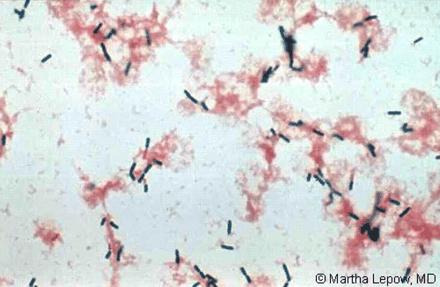 Genus Listeria Γένος Listeria Το γένος, περιλαμβάνει 8 είδη, τρία από τα οποία είναι παθογόνα. L. monocytogenes: το κύριο παθογόνο του γένους για ανθρώπους και ζώα. L. ivanovii :προκαλεί αποβολές σε πρόβατα και βοοειδή L.