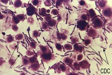 Bacillus anthracis Γένος Bacillus Το γένος αυτό περιλαμβάνει ένα μεγάλο αριθμό σπορογόνων gram θετικών βακτηρίων τα οποία στην πλειονότητά τους είναι μη παθογόνα, σαπρόφυτα του εδάφους με εξαίρεση