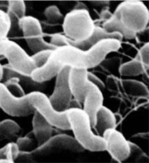 Genus Campylobacter Γένος Campylobacter Το γένος, σύμφωνα με τη νέα έκδοση του LPNS, 2005 (List of Prokaryotik Names with Standing in Nomenclature), περιλαμβάνει 17 είδη.