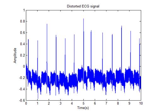 Σχήμα 3.11: Αρχικό καθαρό σήμα ΗΚΓ, συχνότητας δειγματοληψίας 360Hz που εξάχθηκε από τη βάση δεδομένων MIT-BIH Arrhythmia Database. Σχήμα 3.