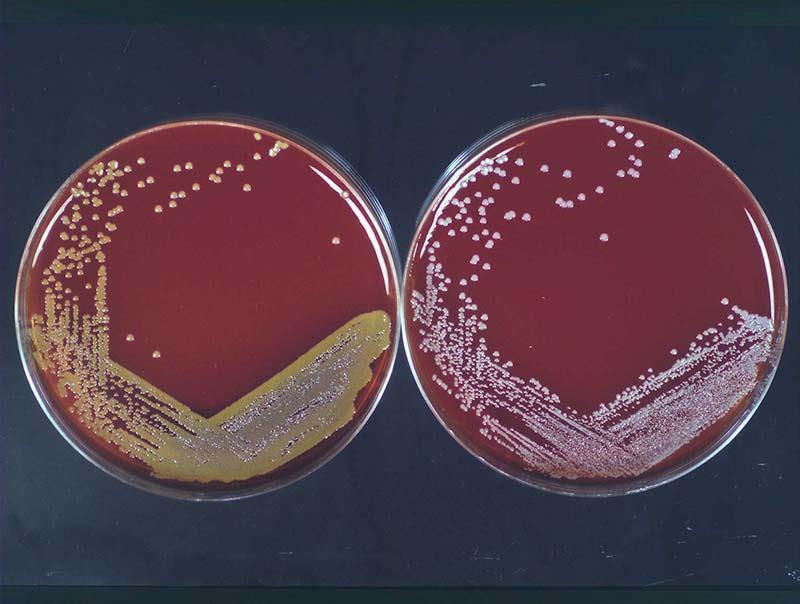 Staphylococcus aureus and
