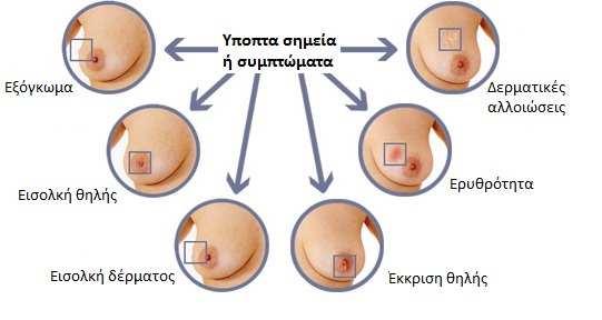 Κεφάλαιο 3 Συμπτωματολογία - Κλινική εικόνα Οι νοσολογικές οντότητες που αφορούν στο μαστό διακρίνονται σε καλοήθεις και κακοήθεις.